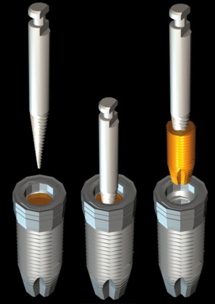 Extracteur de vis cassées - Lapeyre optique