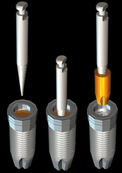 EXTRACTEUR  VIS + ADAPTATEUR